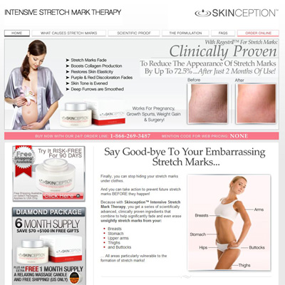 review stretch mark