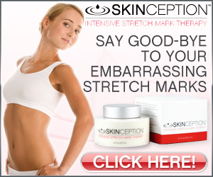 best stretch mark treatment uk